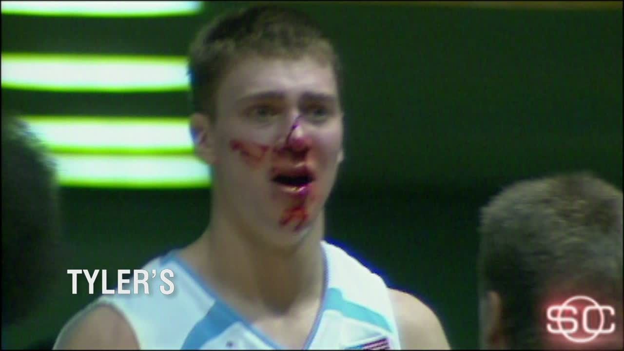 Who could forget Hansbrough's bloody nose - ESPN Video