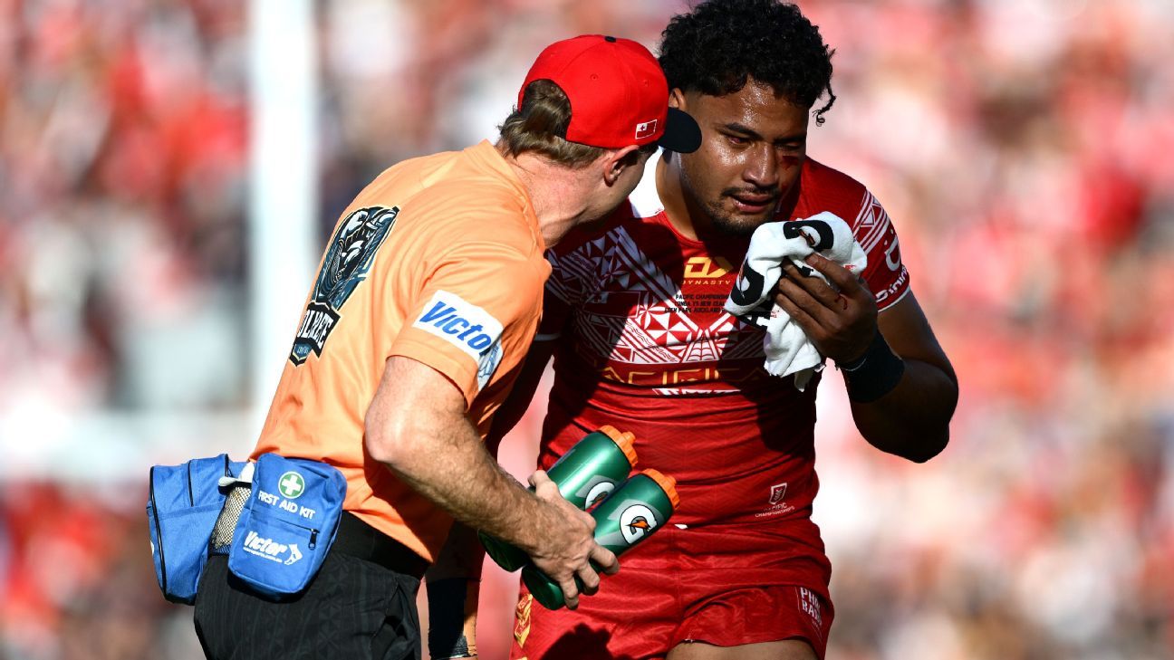 Tonga's Katoa being monitored after 'brain bleed'